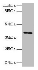 MAGE10 / MAGEA10 Antibody - Western blot All lanes: MAGEA10 antibody at 2µg/ml + HL60 whole cell lysate Secondary Goat polyclonal to rabbit IgG at 1/10000 dilution Predicted band size: 41 kDa Observed band size: 41 kDa
