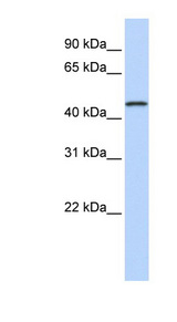 MAGE10 / MAGEA10 Antibody - MAGEA10 antibody Western blot of Fetal Heart lysate. This image was taken for the unconjugated form of this product. Other forms have not been tested.
