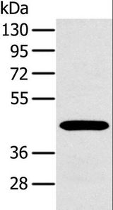 MAGE10 / MAGEA10 Antibody - Western blot analysis of A375 cell, using MAGEA10 Polyclonal Antibody at dilution of 1:400.