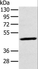 MAGE10 / MAGEA10 Antibody - Western blot analysis of A375 cell, using MAGEA10 Polyclonal Antibody at dilution of 1:200.