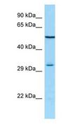 MAGE12 / MAGEA12 Antibody - MAGE12 / MAGEA12 antibody Western Blot of THP-1.  This image was taken for the unconjugated form of this product. Other forms have not been tested.