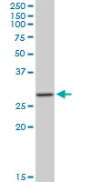 MAGE12 / MAGEA12 Antibody - MAGEA12 monoclonal antibody (M01), clone 3A10. Western Blot analysis of MAGEA12 expression in human liver.