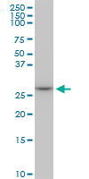 MAGE12 / MAGEA12 Antibody - MAGEA12 monoclonal antibody (M01), clone 3A10. Western Blot analysis of MAGEA12 expression in Raw 264.7.