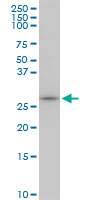 MAGE12 / MAGEA12 Antibody - MAGEA12 monoclonal antibody (M01), clone 3A10. Western Blot analysis of MAGEA12 expression in NIH/3T3.