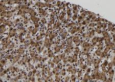 MAGE12 / MAGEA12 Antibody - 1:100 staining human liver tissue by IHC-P. The sample was formaldehyde fixed and a heat mediated antigen retrieval step in citrate buffer was performed. The sample was then blocked and incubated with the antibody for 1.5 hours at 22°C. An HRP conjugated goat anti-rabbit antibody was used as the secondary.