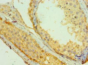 MAGEA1 / MAGE 1 Antibody - Immunohistochemistry of paraffin-embedded human testicle using antibody at 1:100 dilution.