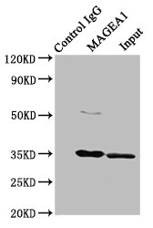 MAGEA1 / MAGE 1 Antibody - Immunoprecipitating MAGEA1 in Hela whole cell lysate Lane 1: Rabbit control IgG instead of MAGEA1 Antibody in Hela whole cell lysate.For western blotting, a HRP-conjugated Protein G antibody was used as the secondary antibody (1/2000) Lane 2: MAGEA1 Antibody (8µg) + Hela whole cell lysate (500µg) Lane 3: Hela whole cell lysate (10µg)