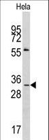 MAGEA1 / MAGE 1 Antibody - Western blot of anti-MAGEA1 Antibody (RB02082) in HeLa cell line lysates (35 ug/lane). MAGEA1(arrow) was detected using the purified antibody.