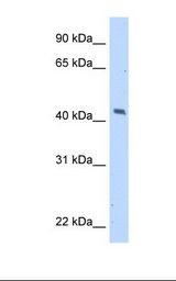 MAGEA1 / MAGE 1 Antibody - Transfected 293T cell lysate. Antibody concentration: 5.0 ug/ml. Gel concentration: 12%.  This image was taken for the unconjugated form of this product. Other forms have not been tested.