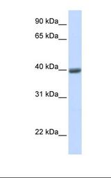 MAGEA1 / MAGE 1 Antibody - Fetal heart lysate. Antibody concentration: 1.0 ug/ml. Gel concentration: 12%.  This image was taken for the unconjugated form of this product. Other forms have not been tested.