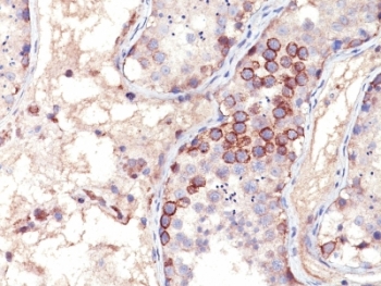 MAGEA1 / MAGE 1 Antibody - Formalin-fixed, paraffin-embedded human testis stained with MAGE-1 antibody (MA454).  This image was taken for the unmodified form of this product. Other forms have not been tested.