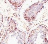 MAGEA1 / MAGE 1 Antibody - Formalin-fixed, paraffin-embedded human testis stained with MAGE-1 antibody (SPM282).  This image was taken for the unmodified form of this product. Other forms have not been tested.