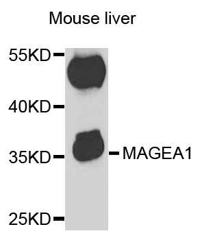 MAGEA1 / MAGE 1 Antibody - Western blot analysis of extracts of mouse liver.