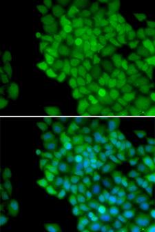 MAGEA1 / MAGE 1 Antibody - Immunofluorescence analysis of HeLa cells.