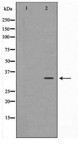 MAGEA1 / MAGE 1 Antibody - Western blot of HepG2 cell lysate using MAGE-1 Antibody