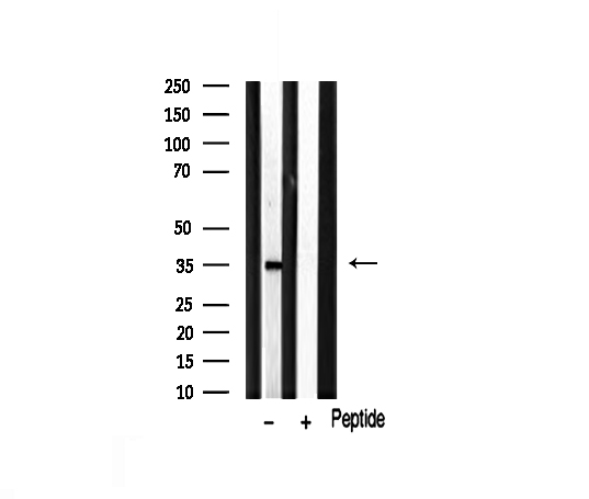 MAGEA1 / MAGE 1 Antibody - Western blot analysis on rat brain lysate using MAGE-1 antibody