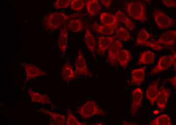 MAGEA1 / MAGE 1 Antibody - Staining HepG2 cells by IF/ICC. The samples were fixed with PFA and permeabilized in 0.1% Triton X-100, then blocked in 10% serum for 45 min at 25°C. The primary antibody was diluted at 1:200 and incubated with the sample for 1 hour at 37°C. An Alexa Fluor 594 conjugated goat anti-rabbit IgG (H+L) Ab, diluted at 1/600, was used as the secondary antibody.