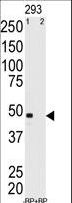 MAGEA11 Antibody - Western blot of anti-MAGEA11 Antibody pre-incubated with and without blocking peptide in 293 cell line lysate. MAGEA11(arrow) was detected using the purified antibody.