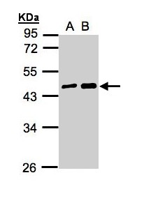 MAGEA11 Antibody - Sample (30 ug whole cell lysate). A: A431, B: H1299. 10% SDS PAGE. MAGEA11 antibody diluted at 1:5000