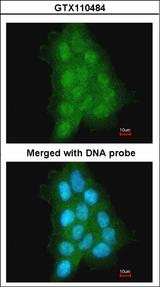 MAGEA11 Antibody - Immunofluorescence of paraformaldehyde-fixed A431 using MAGEA11 antibody at 1:500 dilution.