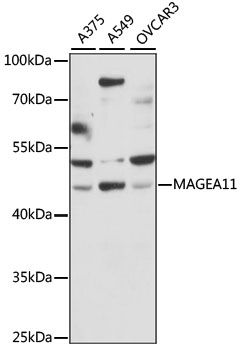 MAGEA11 Antibody - Western blot analysis of extracts of various cell lines, using MAGEA11 antibody at 1:1000 dilution. The secondary antibody used was an HRP Goat Anti-Rabbit IgG (H+L) at 1:10000 dilution. Lysates were loaded 25ug per lane and 3% nonfat dry milk in TBST was used for blocking. An ECL Kit was used for detection and the exposure time was 30s.