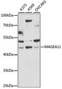 MAGEA11 Antibody - Western blot analysis of extracts of various cell lines, using MAGEA11 antibody at 1:1000 dilution. The secondary antibody used was an HRP Goat Anti-Rabbit IgG (H+L) at 1:10000 dilution. Lysates were loaded 25ug per lane and 3% nonfat dry milk in TBST was used for blocking. An ECL Kit was used for detection and the exposure time was 30s.