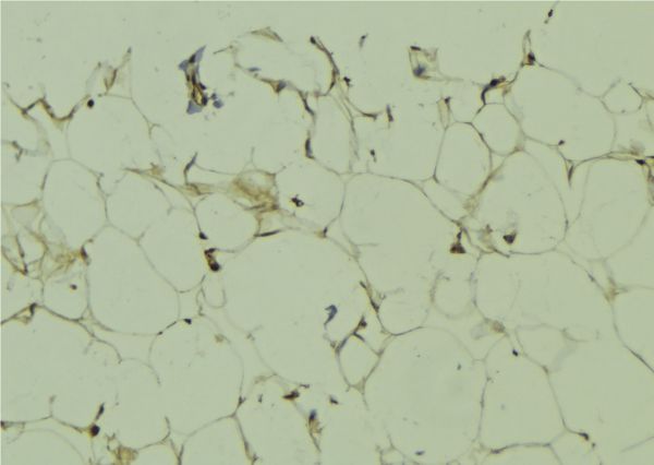 MAGEA11 Antibody - 1:100 staining human lung tissue by IHC-P. The sample was formaldehyde fixed and a heat mediated antigen retrieval step in citrate buffer was performed. The sample was then blocked and incubated with the antibody for 1.5 hours at 22°C. An HRP conjugated goat anti-rabbit antibody was used as the secondary.