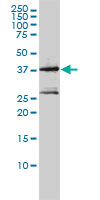 MAGEA2 Antibody - MAGEA2 monoclonal antibody (M01), clone 1H4 Western Blot analysis of MAGEA2 expression in Jurkat.