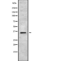 MAGEA2 Antibody - Western blot analysis of MAGA2 using 293 whole cells lysates