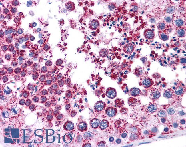 MAGEA3 Antibody - Anti-MAGEA3 antibody IHC of human testis. Immunohistochemistry of formalin-fixed, paraffin-embedded tissue after heat-induced antigen retrieval. Antibody concentration 5 ug/ml.  This image was taken for the unconjugated form of this product. Other forms have not been tested.