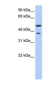 MAGEA3 Antibody - MAGEA3 antibody Western blot of Fetal Liver lysate. This image was taken for the unconjugated form of this product. Other forms have not been tested.