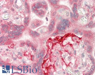 MAGEA3 Antibody - Human Placenta: Formalin-Fixed, Paraffin-Embedded (FFPE)