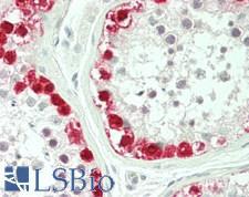 MAGEA3 Antibody - Human Testis: Formalin-Fixed, Paraffin-Embedded (FFPE)