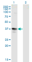 MAGEA3 Antibody - Western Blot analysis of MAGEA3 expression in transfected 293T cell line by MAGEA3 monoclonal antibody (M01), clone 6D10.Lane 1: MAGEA3 transfected lysate (Predicted MW: 34.7 KDa).Lane 2: Non-transfected lysate.