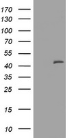 MAGEA3 Antibody - HEK293T cells were transfected with the pCMV6-ENTRY control (Left lane) or pCMV6-ENTRY MAGEA3 (Right lane) cDNA for 48 hrs and lysed. Equivalent amounts of cell lysates (5 ug per lane) were separated by SDS-PAGE and immunoblotted with anti-MAGEA3.