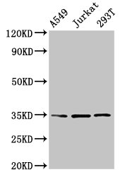 MAGEA3 Antibody - Positive Western Blot detected in A549 whole cell lysate, Jurkat whole cell lysate, 293T whole cell lysate. All lanes: MAGEA3 antibody at 4 µg/ml Secondary Goat polyclonal to rabbit IgG at 1/50000 dilution. Predicted band size: 35 KDa. Observed band size: 35 KDa