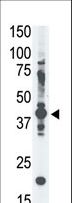 MAGEA4 Antibody - The anti-MAGE-A4 antibody is used in Western blot to detect MAGE-A4 in A375 cell lysate.