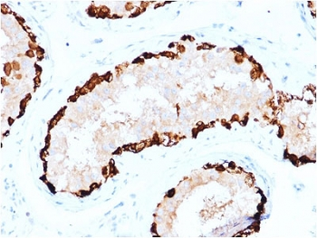 MAGEA4 Antibody - IHC testing of FFPE human testis stained with MAGEA4 antibody. Required HIER: boiling tissue sections in 10mM citrate buffer, pH6, for 10-20 min followed by cooling at RT for 20 min.