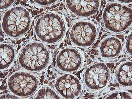 MAGEA4 Antibody - IHC of paraffin-embedded Human colon tissue using anti-MAGEA4 mouse monoclonal antibody.