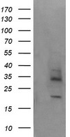 MAGEA4 Antibody - HEK293T cells were transfected with the pCMV6-ENTRY control (Left lane) or pCMV6-ENTRY MAGEA4 (Right lane) cDNA for 48 hrs and lysed. Equivalent amounts of cell lysates (5 ug per lane) were separated by SDS-PAGE and immunoblotted with anti-MAGEA4.