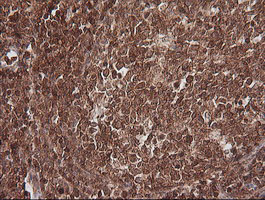 MAGEA4 Antibody - IHC of paraffin-embedded Human lymph node tissue using anti-MAGEA4 mouse monoclonal antibody.