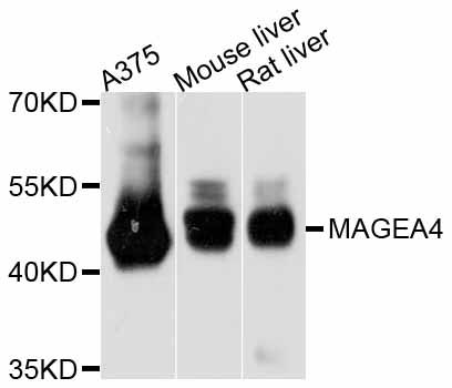 MAGEA4 Antibody - Western blot analysis of extracts of various cell lines, using MAGEA4 antibody at 1:3000 dilution. The secondary antibody used was an HRP Goat Anti-Rabbit IgG (H+L) at 1:10000 dilution. Lysates were loaded 25ug per lane and 3% nonfat dry milk in TBST was used for blocking. An ECL Kit was used for detection and the exposure time was 10s.