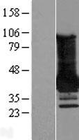 MAGEA4 Protein - Western validation with an anti-DDK antibody * L: Control HEK293 lysate R: Over-expression lysate