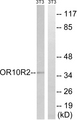 MAGEA5 Antibody - Western blot analysis of lysates from NIH/3T3 cells, using MAGEA5 Antibody. The lane on the right is blocked with the synthesized peptide.