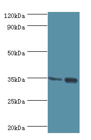MAGEA6 Antibody - Western blot. All lanes: MAGEA6 antibody at 7 ug/ml. Lane 1: rat brain tissue. Lane 2: rat gonad tissue. Secondary antibody: Goat polyclonal to rabbit at 1:10000 dilution. Predicted band size: 35 kDa. Observed band size: 35 kDa Immunohistochemistry.