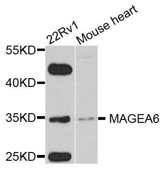 MAGEA6 Antibody - Western blot blot of extract of various cells, using MAGEA6 antibody.