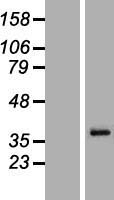 MAGEA6 Protein - Western validation with an anti-DDK antibody * L: Control HEK293 lysate R: Over-expression lysate