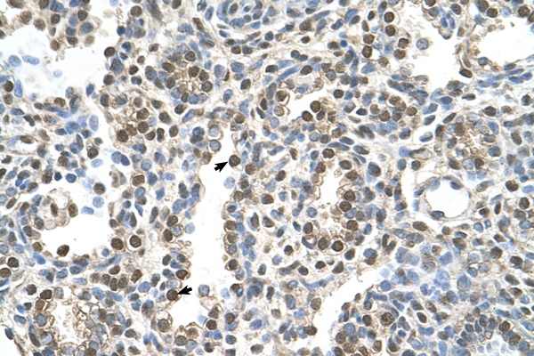 MAGEA8 Antibody - MAGEA8 antibody ARP42233_P050-NP_005355-MAGEA8(melanoma antigen family A, 8) Antibody IHC of formalin-fixed, paraffin-embedded human Lung. Positive label: Alveolar cells indicated with arrows. Antibody concentration 16 ug/ml. Magnification 400X.  This image was taken for the unconjugated form of this product. Other forms have not been tested.