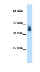 MAGEA8 Antibody - MAGEA8 antibody ARP42233_P050-NP_005355-MAGEA8(melanoma antigen family A, 8) Antibody Western blot of Placenta lysate.  This image was taken for the unconjugated form of this product. Other forms have not been tested.