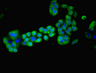 MAGEA8 Antibody - Immunofluorescent analysis of PC-3 cells using MAGEA8 Antibody at dilution of 1:100 and Alexa Fluor 488-congugated AffiniPure Goat Anti-Rabbit IgG(H+L)